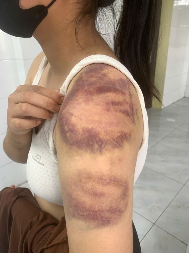 Tạm giữ người đàn ông nhiều lần đánh đập con gái và vợ đang mang thai- Ảnh 1. Tạm giữ người đàn ông nhiều lần đánh đập con gái và vợ đang mang thai- Ảnh 1.