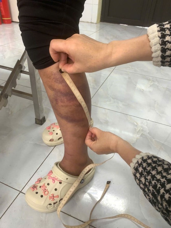 Tạm giữ người đàn ông nhiều lần đánh đập con gái và vợ đang mang thai- Ảnh 2. Tạm giữ người đàn ông nhiều lần đánh đập con gái và vợ đang mang thai- Ảnh 2.