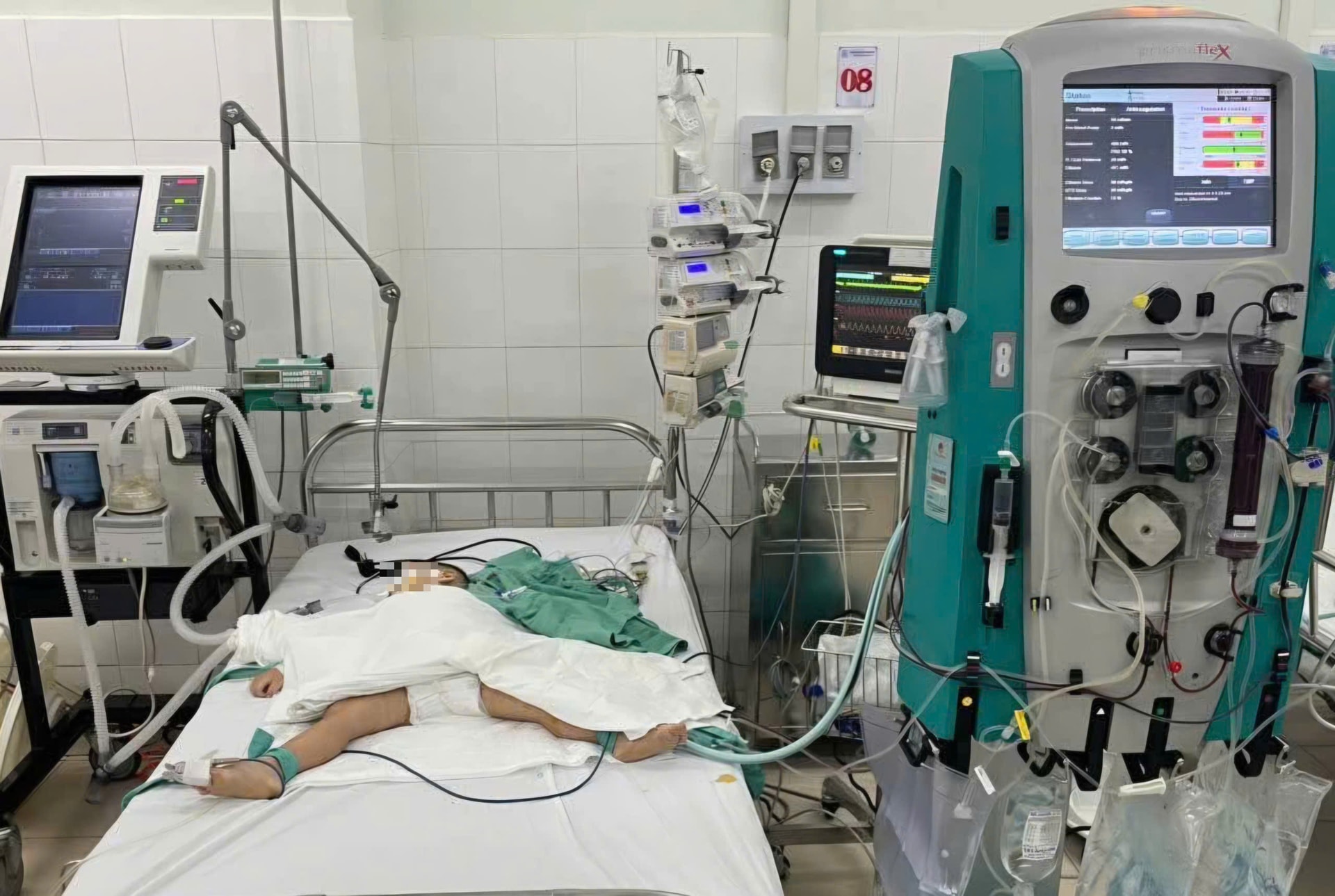 Cứu sống ngoạn mục cháu bé mắc tay chân miệng nguy kịch trong những ngày Tết- Ảnh 1.