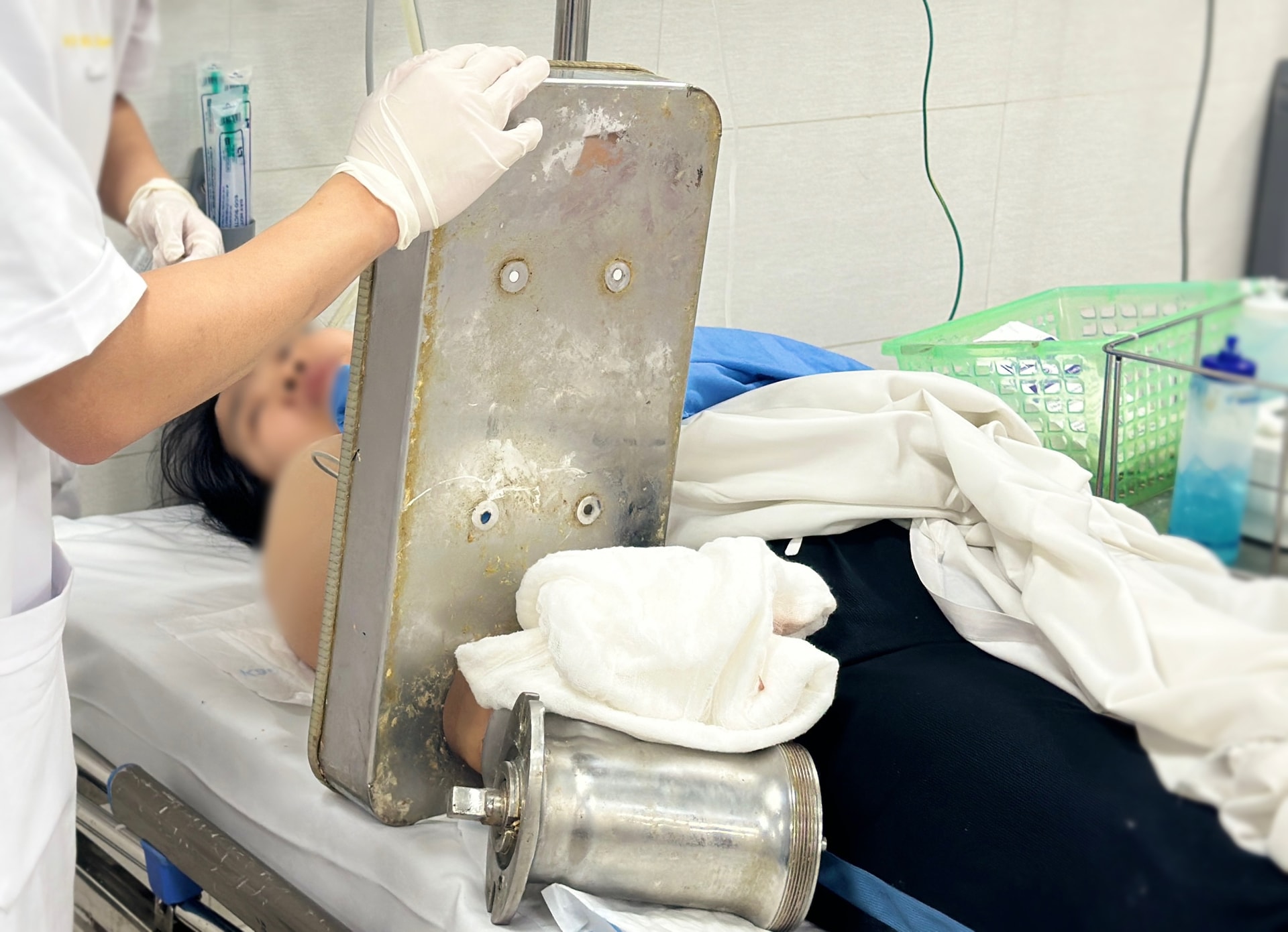 Người phụ nữ nhập viện với bàn tay vẫn còn kẹt nguyên trong máy xay thịt- Ảnh 1. Người phụ nữ nhập viện với bàn tay vẫn còn kẹt nguyên trong máy xay thịt- Ảnh 1.