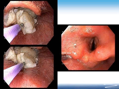 Nuốt vội miếng thịt trong bữa tối, người đàn ông suýt tắc thở- Ảnh 2.