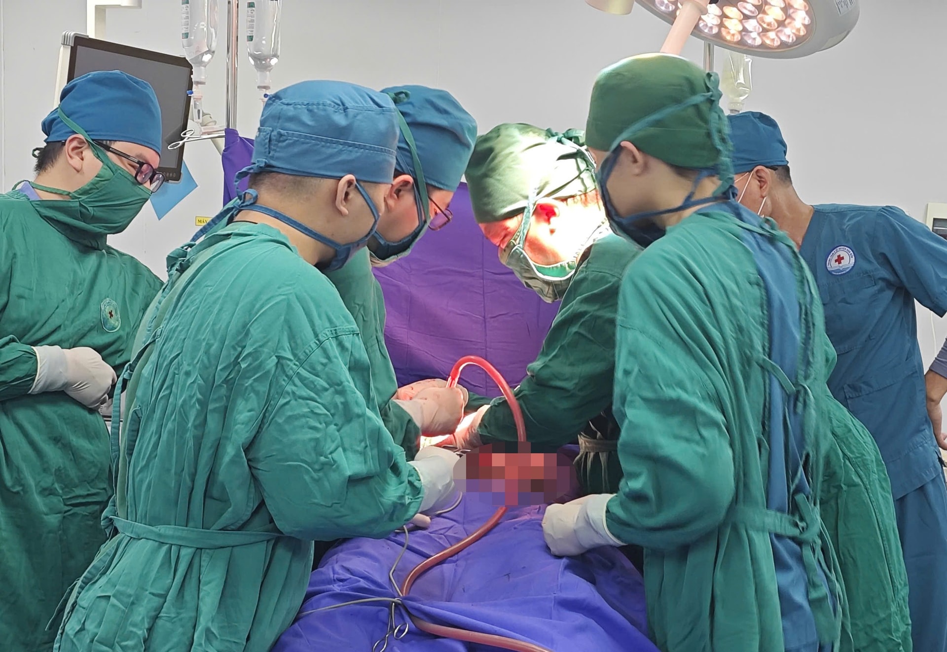 Bác sĩ hiến máu, trực tiếp thực hiện ca mổ cứu sống nam thanh niên bị vỡ thận- Ảnh 1. Bác sĩ hiến máu, trực tiếp thực hiện ca mổ cứu sống nam thanh niên bị vỡ thận- Ảnh 1.