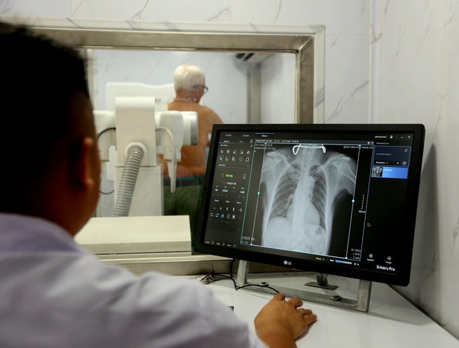 Phát hiện sớm để chặn nguồn lây bệnh lao trong cộng đồng- Ảnh 4. Phát hiện sớm để chặn nguồn lây bệnh lao trong cộng đồng- Ảnh 4.