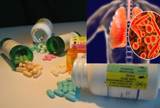 Hiểu đúng về lao kháng thuốc- Ảnh 1. Hiểu đúng về lao kháng thuốc- Ảnh 1.