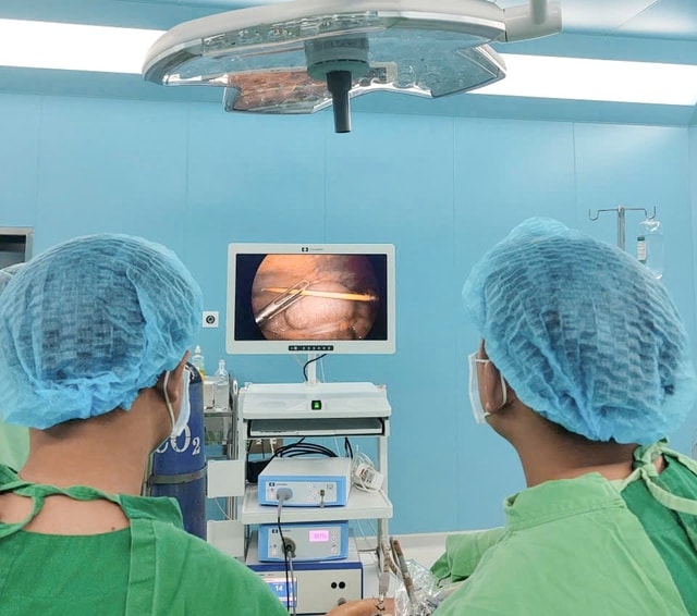 Nuốt tăm không hay biết, người đàn ông 58 tuổi bị thủng đại tràng- Ảnh 1. Nuốt tăm không hay biết, người đàn ông 58 tuổi bị thủng đại tràng- Ảnh 1.