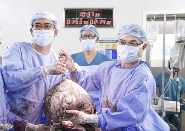 Bụng to bất thường, cô gái 25 tuổi phát hiện u xơ tử cung gần 12kg- Ảnh 2. Bụng to bất thường, cô gái 25 tuổi phát hiện u xơ tử cung gần 12kg- Ảnh 2.