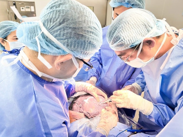 Bụng to bất thường, cô gái 25 tuổi phát hiện u xơ tử cung gần 12kg- Ảnh 1. Bụng to bất thường, cô gái 25 tuổi phát hiện u xơ tử cung gần 12kg- Ảnh 1.