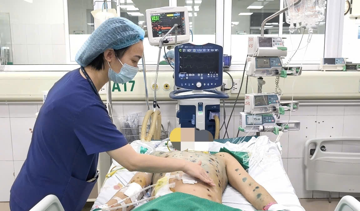 Nhiều người lớn mắc thủy đậu biến chứng nguy kịch- Ảnh 3. Nhiều người lớn mắc thủy đậu biến chứng nguy kịch- Ảnh 3.