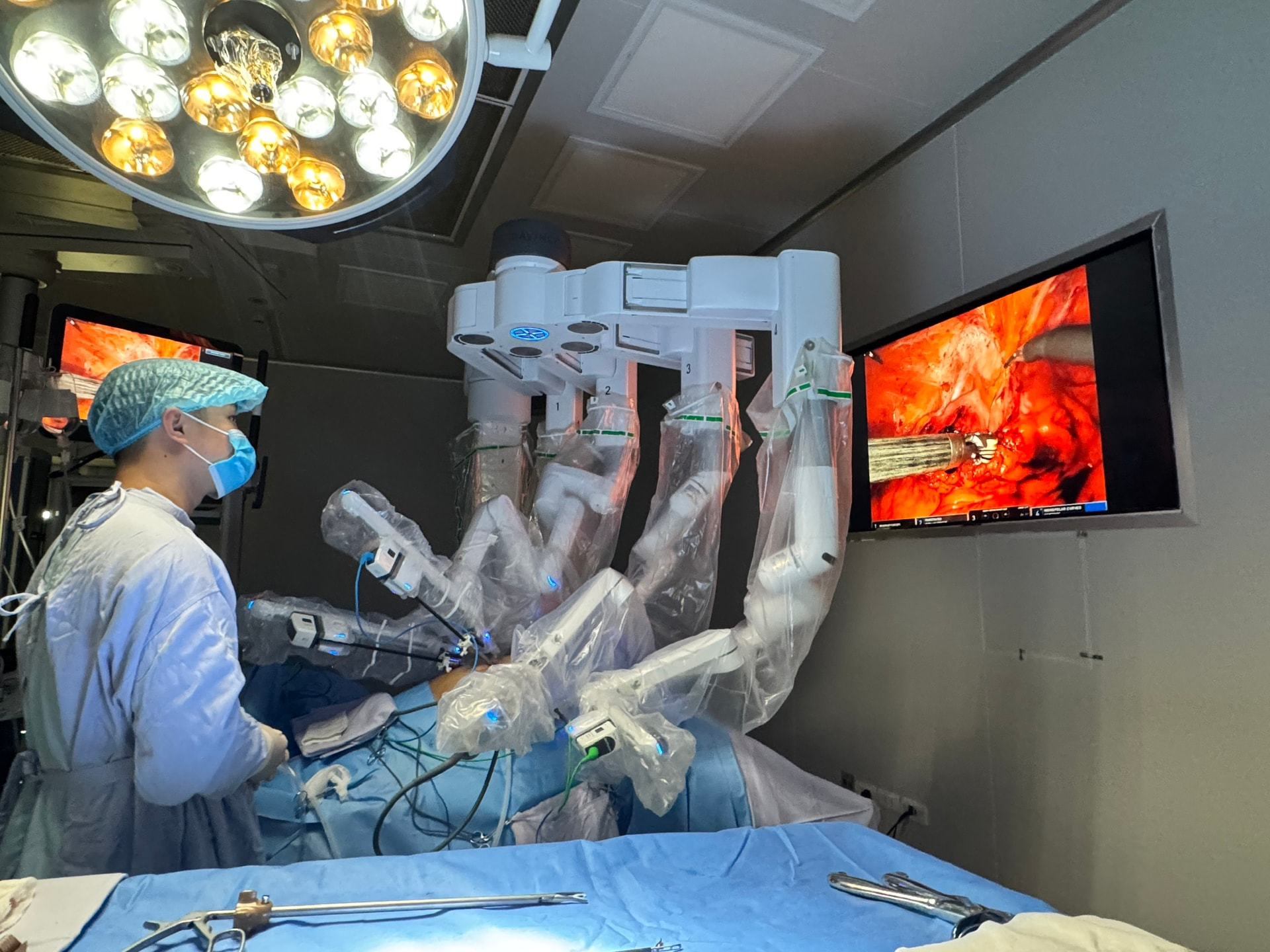 Hành trình 10 năm chiến đấu với ung thư và kỳ tích từ phẫu thuật robot- Ảnh 1. Hành trình 10 năm chiến đấu với ung thư và kỳ tích từ phẫu thuật robot- Ảnh 1.