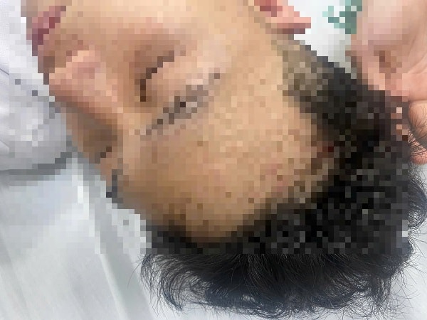 Công an Hà Nội điều tra vụ nam sinh bị nhóm đi ô tô ngược chiều chặn đầu, đánh hội đồng nhập viện- Ảnh 1. Công an Hà Nội điều tra vụ nam sinh bị nhóm đi ô tô ngược chiều chặn đầu, đánh hội đồng nhập viện- Ảnh 1.