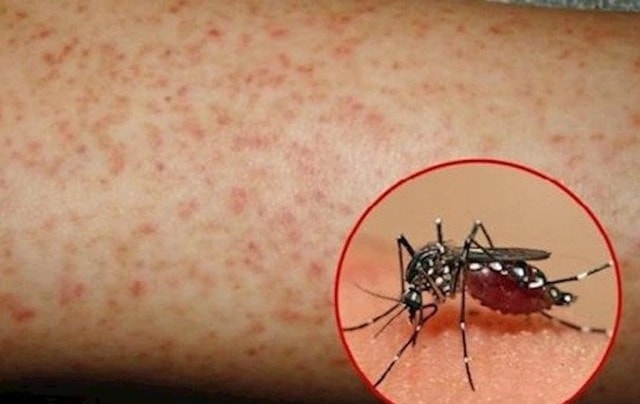 Nguy cơ dịch sốt xuất huyết gia tăng, Lâm Đồng yêu cầu tăng cường giám sát dịch- Ảnh 1.