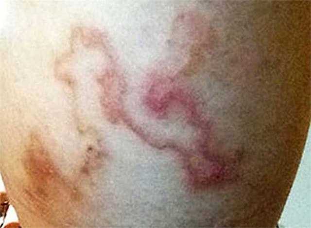 Bệnh ký sinh trùng nhiều người dương tính khi xét nghiệm ở Khánh Hòa nguy hiểm mức nào nếu không điều trị sớm?- Ảnh 2.