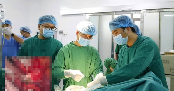 Cụ bà cao tuổi thủng trực tràng vì nuốt hạt nhót- Ảnh 1.