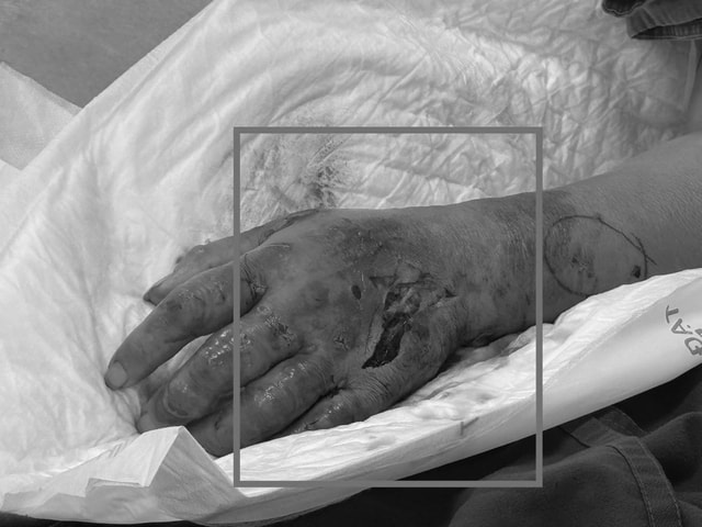 Người phụ nữ sốc nguy kịch sau tiêm thuốc ở phòng khám tư- Ảnh 3.