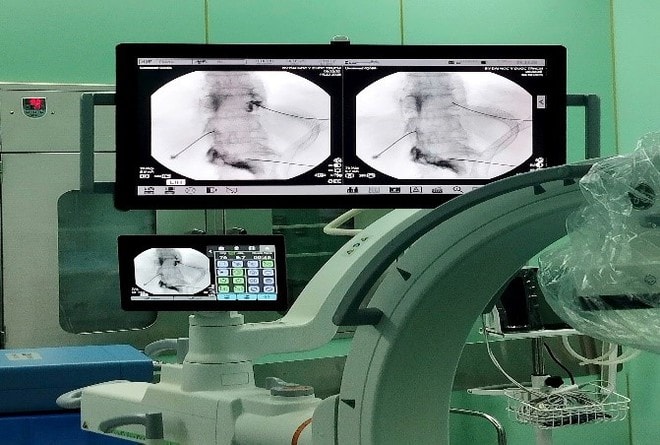 Bệnh viện ĐK TP Vinh triển khai Đơn vị chống đau - Khám, điều trị chuyên sâu các bệnh lý đau mạn tính, đau do bệnh lý thần kinh, cột sống, cơ xương khớp- Ảnh 1. Bệnh viện ĐK TP Vinh triển khai Đơn vị chống đau - Khám, điều trị chuyên sâu các bệnh lý đau mạn tính, đau do bệnh lý thần kinh, cột sống, cơ xương khớp- Ảnh 1.