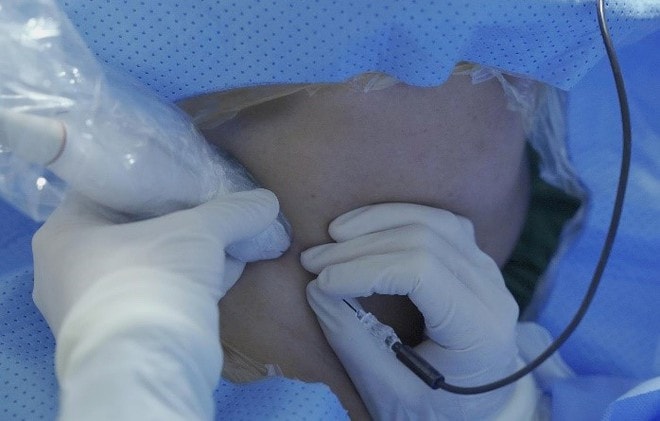 Bệnh viện ĐK TP Vinh triển khai Đơn vị chống đau - Khám, điều trị chuyên sâu các bệnh lý đau mạn tính, đau do bệnh lý thần kinh, cột sống, cơ xương khớp- Ảnh 4. Bệnh viện ĐK TP Vinh triển khai Đơn vị chống đau - Khám, điều trị chuyên sâu các bệnh lý đau mạn tính, đau do bệnh lý thần kinh, cột sống, cơ xương khớp- Ảnh 4.