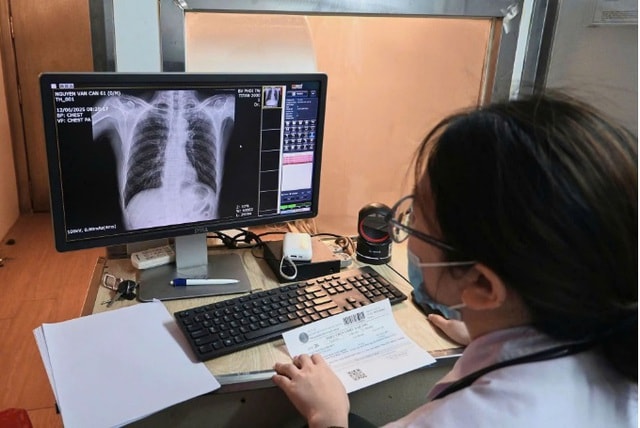 Bệnh viện Phổi Trung ương triển khai xe X-quang lưu động tại Ngày Sức khỏe toàn dân 7/4- Ảnh 1. Bệnh viện Phổi Trung ương triển khai xe X-quang lưu động tại Ngày Sức khỏe toàn dân 7/4- Ảnh 1.