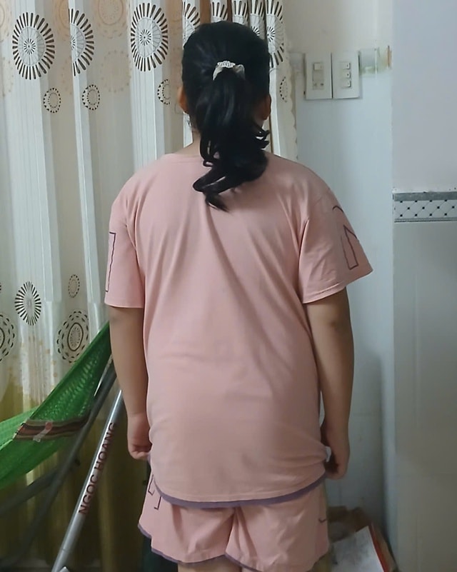 Nhiều trẻ em ở Khánh Hòa phải đến bệnh viện vì có dấu hiệu nghi ngờ dậy thì sớm- Ảnh 1.