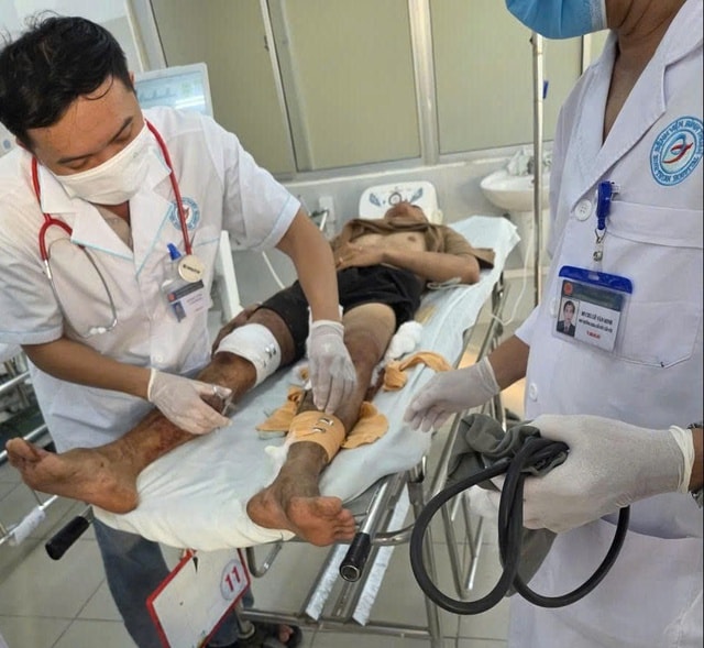 Xe khách lao xuống vực ở Lâm Đồng, 4 người tử vong, nhiều người bị thương- Ảnh 2.