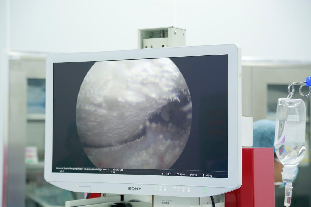 Dùng mẹo dân gian chữa gout, người đàn ông đối mặt nguy cơ tàn phế- Ảnh 2.