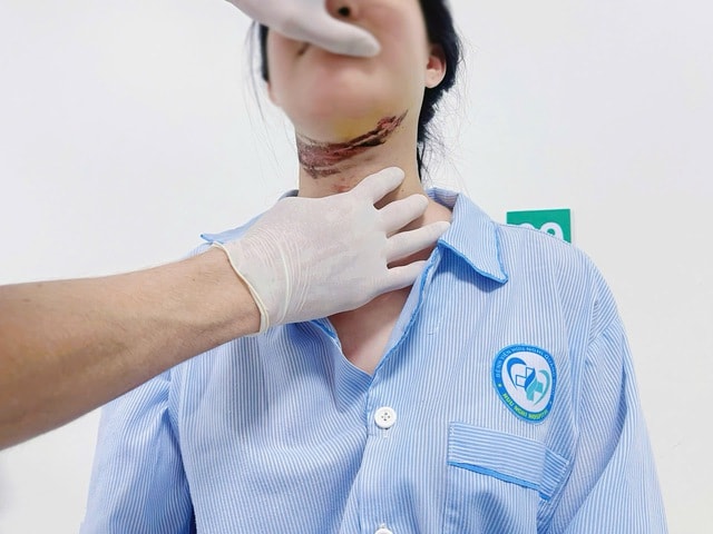 Nữ sinh bị dây điện quấn vào cổ trên đường đi học về- Ảnh 1.