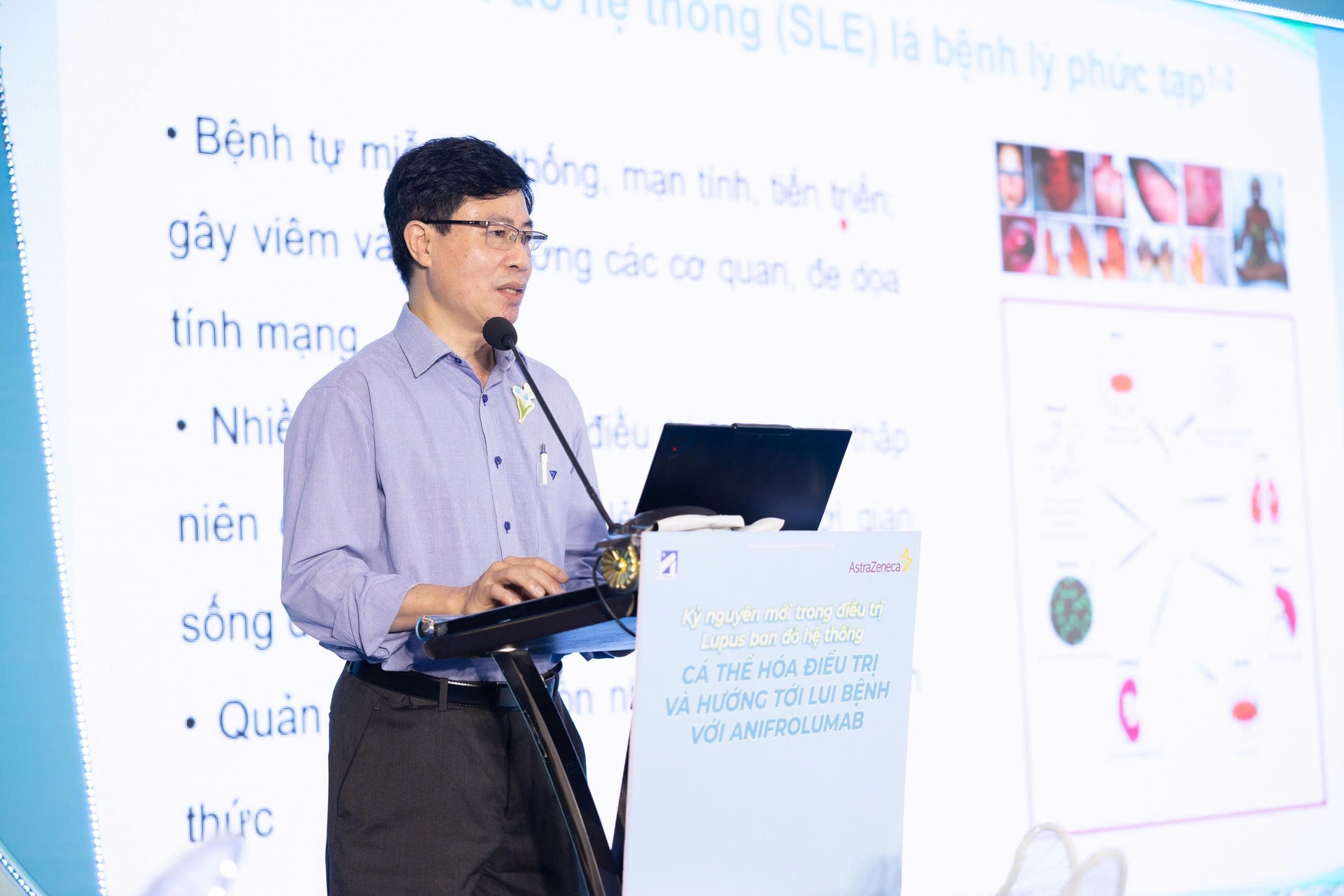 Triệu chứng mơ hồ, chỉ khoảng 10% bệnh nhân Lupus ban đỏ được chẩn đoán sớm- Ảnh 1. Triệu chứng mơ hồ, chỉ khoảng 10% bệnh nhân Lupus ban đỏ được chẩn đoán sớm- Ảnh 1.