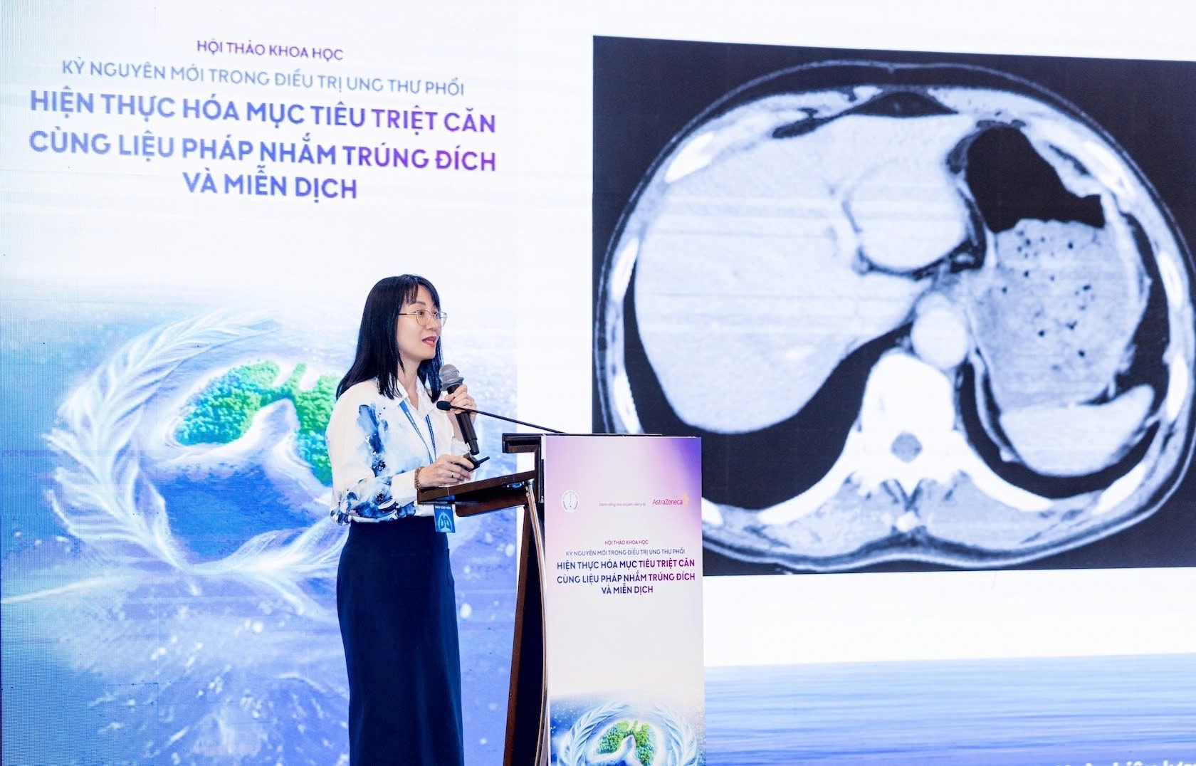 Bước tiến mới trong điều trị ung thư phổi giúp kéo dài chất lượng sống cho người bệnh- Ảnh 2. Bước tiến mới trong điều trị ung thư phổi giúp kéo dài chất lượng sống cho người bệnh- Ảnh 2.