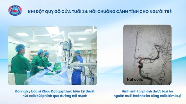 Bệnh viện Hữu nghị Việt Tiệp cứu sống bệnh nhân 24 tuổi bị đột quỵ- Ảnh 2.