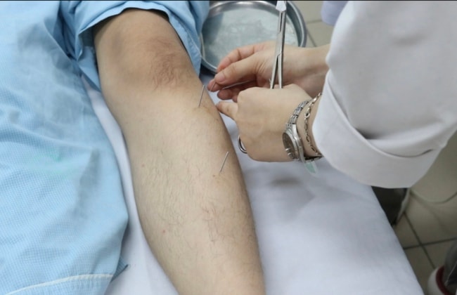 Nam sinh bị liệt vận động do thói quen ngồi khoanh chân - Ảnh 2.