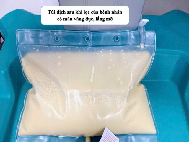 Từ bàn nhậu đến phòng cấp cứu: Lằn ranh sinh tử rất mỏng- Ảnh 2.