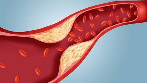 Canxi rất cần cho người cao tuổi, nhưng khi bổ sung cần tránh 3 điều này- Ảnh 2.