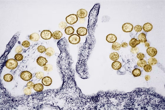 Hantavirus khiến 3 người trên du thuyền MV Hondius tử vong nguy hiểm ra sao?- Ảnh 2.