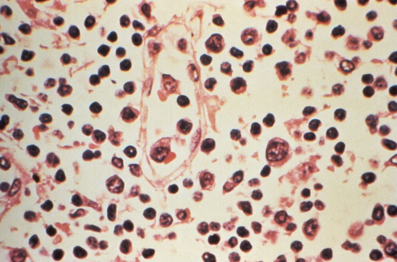 Thách thức trong cuộc đua phát triển vaccine phòng virus Hanta- Ảnh 2.