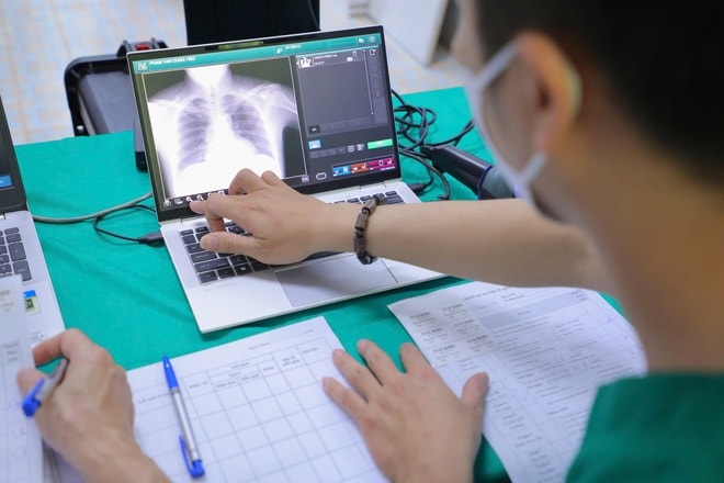 Gần 2.000 người dân vùng cao được khám sức khỏe, sàng lọc lao miễn phí- Ảnh 6.