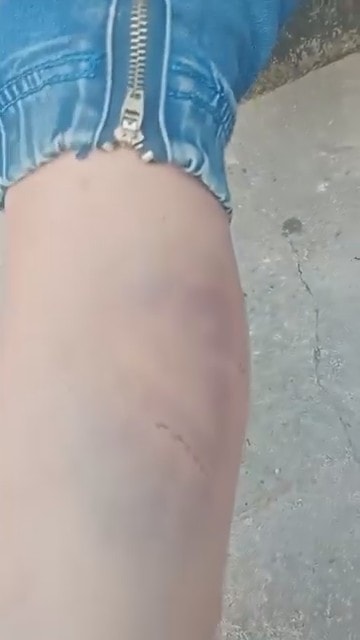 Bé trai nghi bị bạo hành ở Nghệ An được đưa đến cơ sở y tế thăm khám- Ảnh 1.