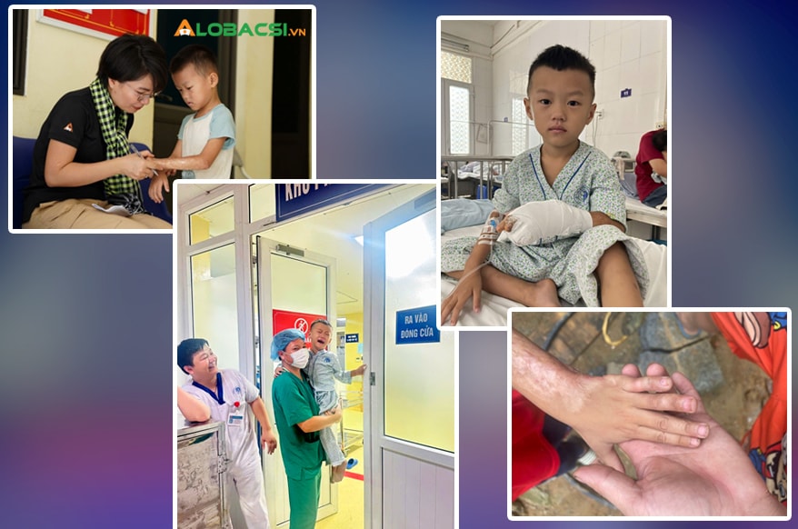 20 năm khoa Phẫu thuật tạo hình, Bệnh viện Xanh Pôn: Chữa lành khuyết hổng, rẽ hướng hàng vạn cuộc đời khiếm khuyết- Ảnh 4. 20 năm khoa Phẫu thuật tạo hình, Bệnh viện Xanh Pôn: Chữa lành khuyết hổng, rẽ hướng hàng vạn cuộc đời khiếm khuyết- Ảnh 4.
