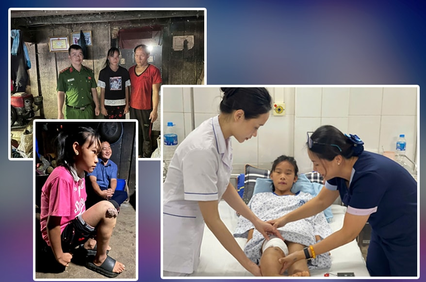 20 năm khoa Phẫu thuật tạo hình, Bệnh viện Xanh Pôn: Chữa lành khuyết hổng, rẽ hướng hàng vạn cuộc đời khiếm khuyết- Ảnh 6. 20 năm khoa Phẫu thuật tạo hình, Bệnh viện Xanh Pôn: Chữa lành khuyết hổng, rẽ hướng hàng vạn cuộc đời khiếm khuyết- Ảnh 6.