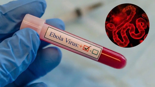 TPHCM tăng cường giám sát trước nguy cơ dịch Ebola xâm nhập- Ảnh 1.
