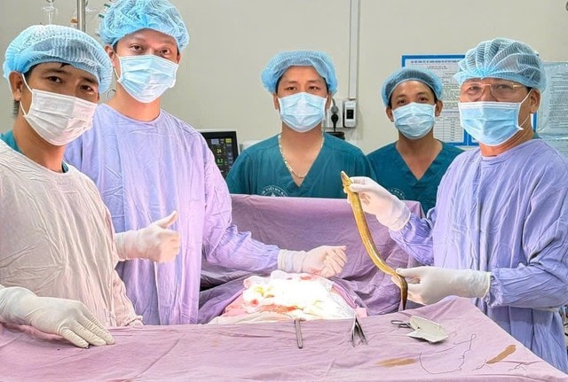Đau bụng dữ dội, bác sĩ phát hiện con lươn dài hơn 50cm trongổ bụng người đàn ông- Ảnh 1. Đau bụng dữ dội, bác sĩ phát hiện con lươn dài hơn 50cm trongổ bụng người đàn ông- Ảnh 1.