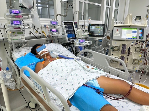 Đá bóng dưới trời nắng, bé trai sốc nhiệt biến chứng huỷ cơ, suy đa cơ quan- Ảnh 1. Đá bóng dưới trời nắng, bé trai sốc nhiệt biến chứng huỷ cơ, suy đa cơ quan- Ảnh 1.