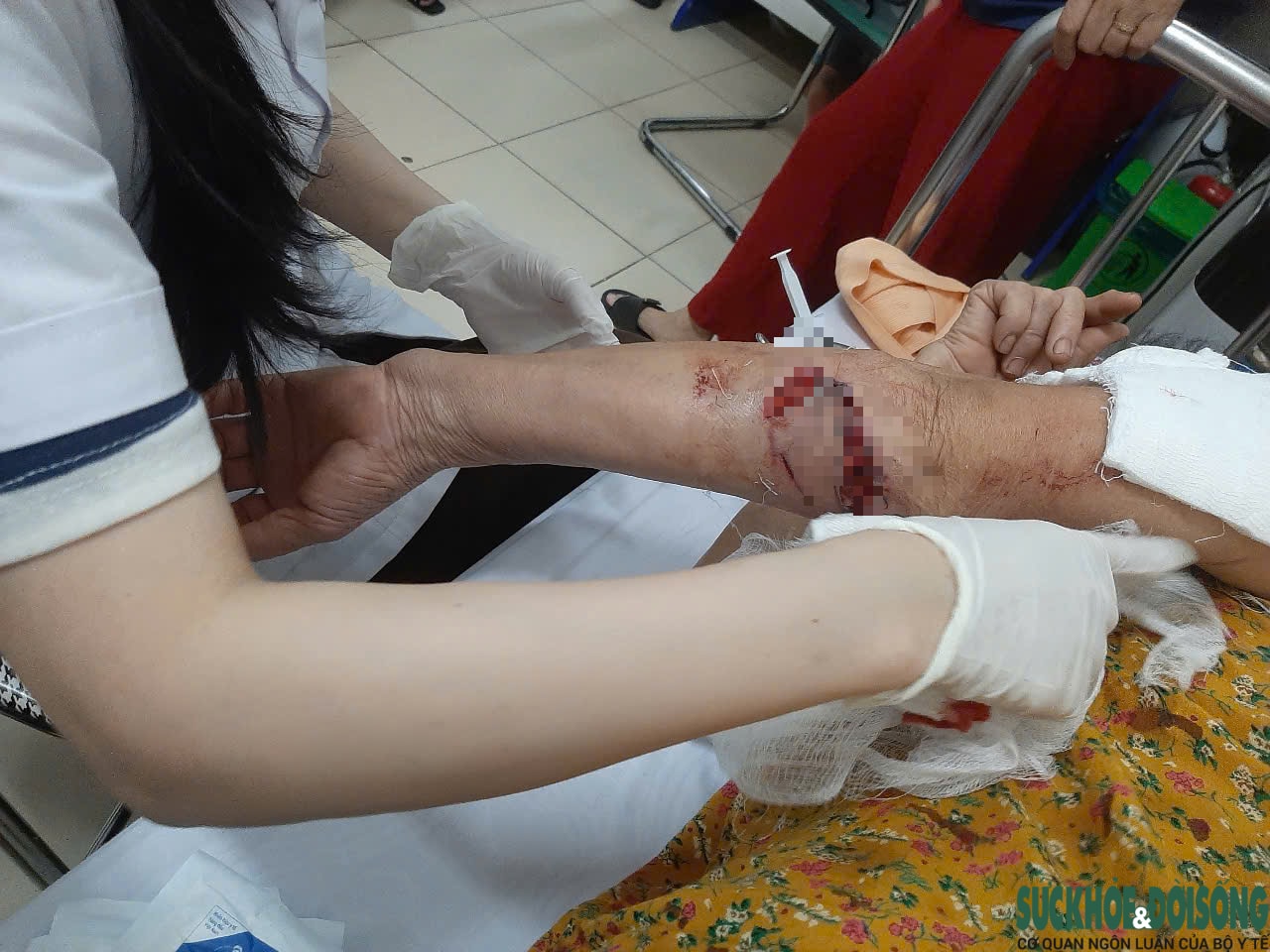 Nỗi ám ảnh mang tên chó thả rông- Ảnh 3.