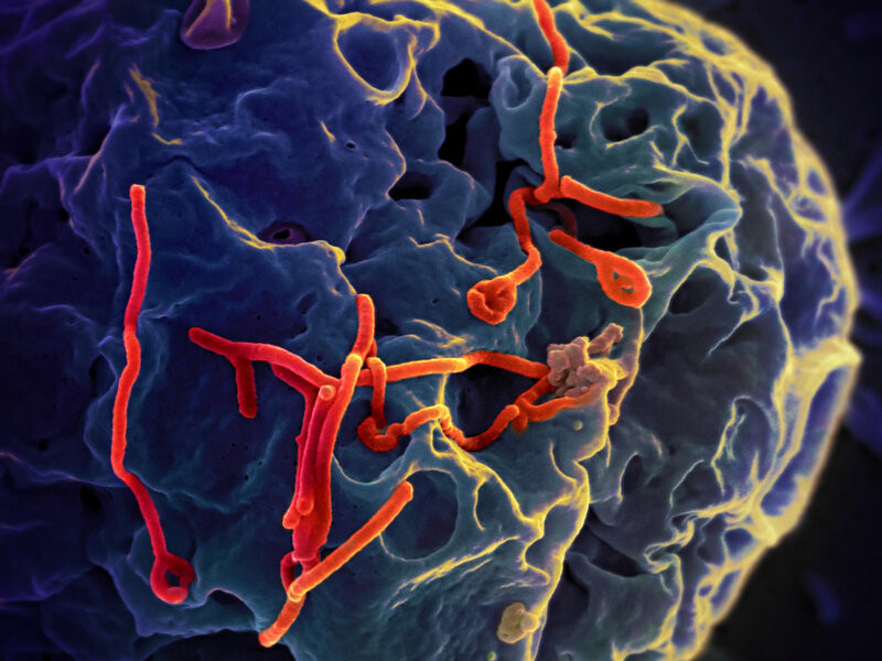 Chuyên gia nói gì về nguy cơ Ebola bùng phát thành đại dịch toàn cầu?- Ảnh 2. Chuyên gia nói gì về nguy cơ Ebola bùng phát thành đại dịch toàn cầu?- Ảnh 2.