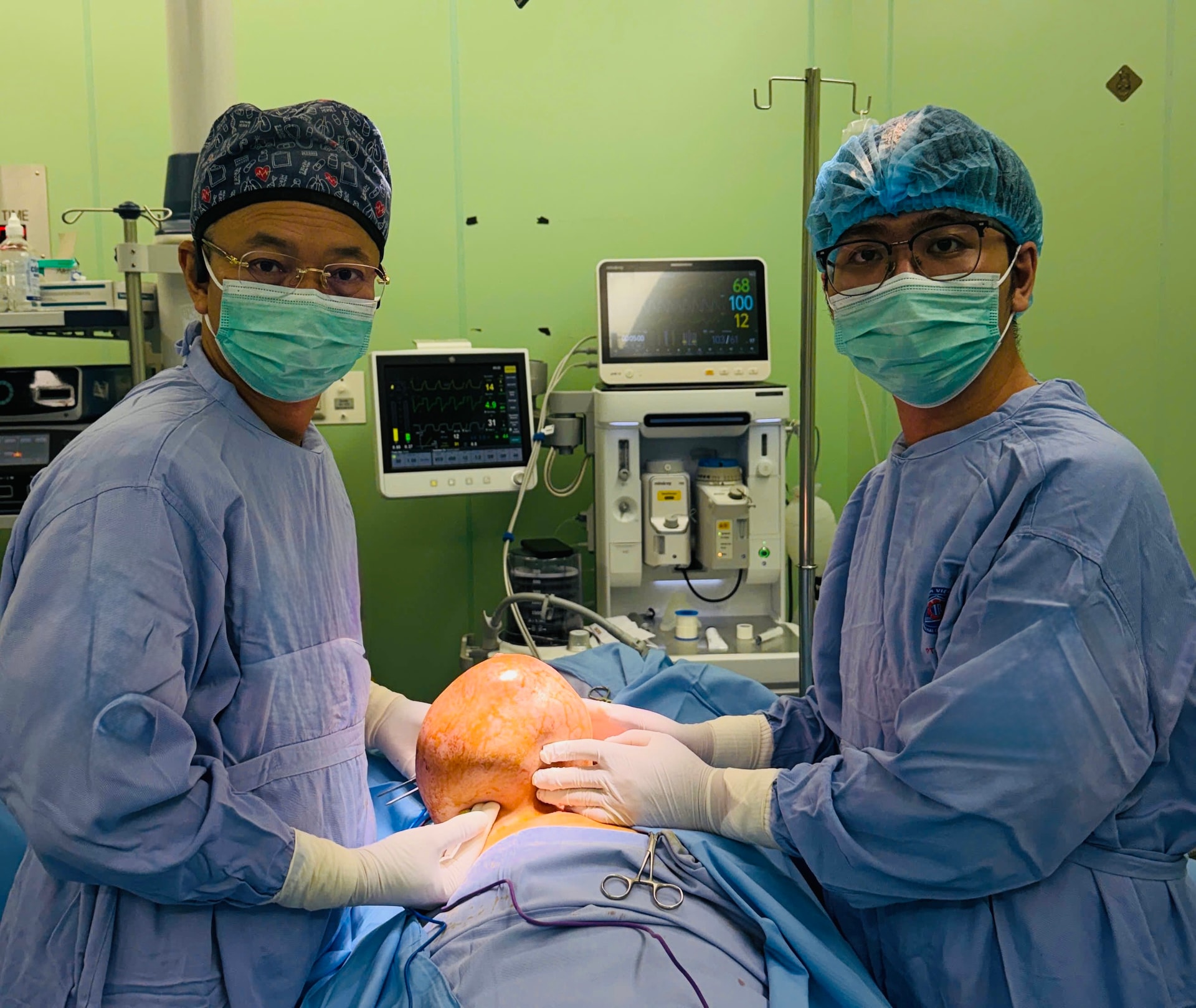 Ngại không đi khám sớm, người bệnh chịu đựng khối u vú nặng gần 4kg- Ảnh 1.