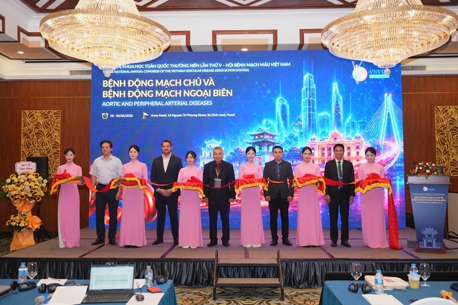 Phát triển nhiều kỹ thuật chuyên sâu trong điều trị bệnh lý mạch máu- Ảnh 3. Phát triển nhiều kỹ thuật chuyên sâu trong điều trị bệnh lý mạch máu- Ảnh 3.