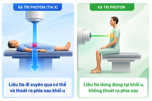 Vận hành hệ thống xạ trị proton tư thế ngồi đầu tiên thế giới, dự kiến về Việt Nam đầu 2027- Ảnh 2. Vận hành hệ thống xạ trị proton tư thế ngồi đầu tiên thế giới, dự kiến về Việt Nam đầu 2027- Ảnh 2.
