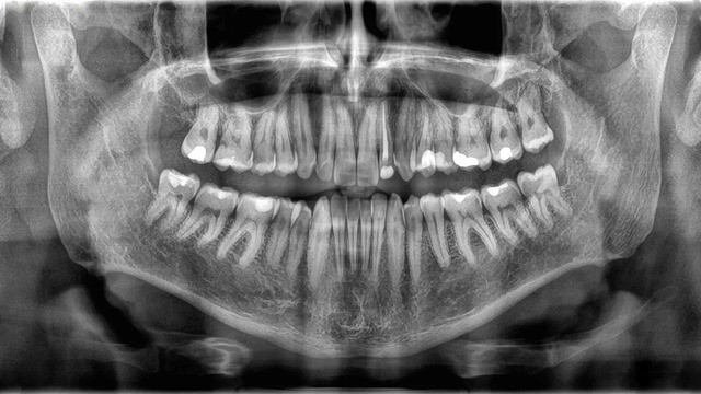 Răng có được xem là xương không?- Ảnh 1.