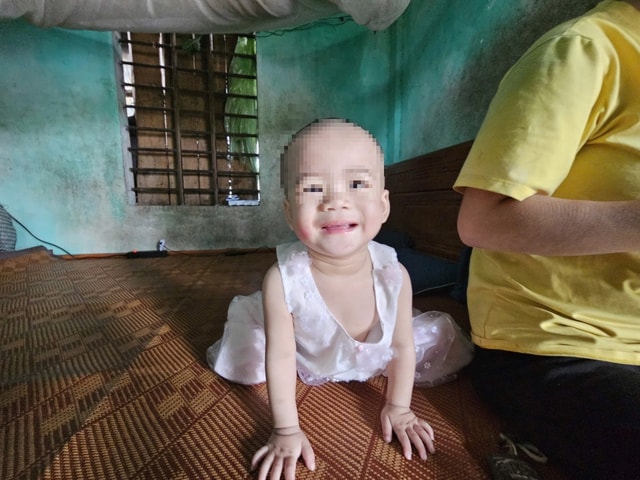 Tình trạng của cháu bé bị mẹ và cậu tâm thần gây hại- Ảnh 2. Tình trạng của cháu bé bị mẹ và cậu tâm thần gây hại- Ảnh 2.
