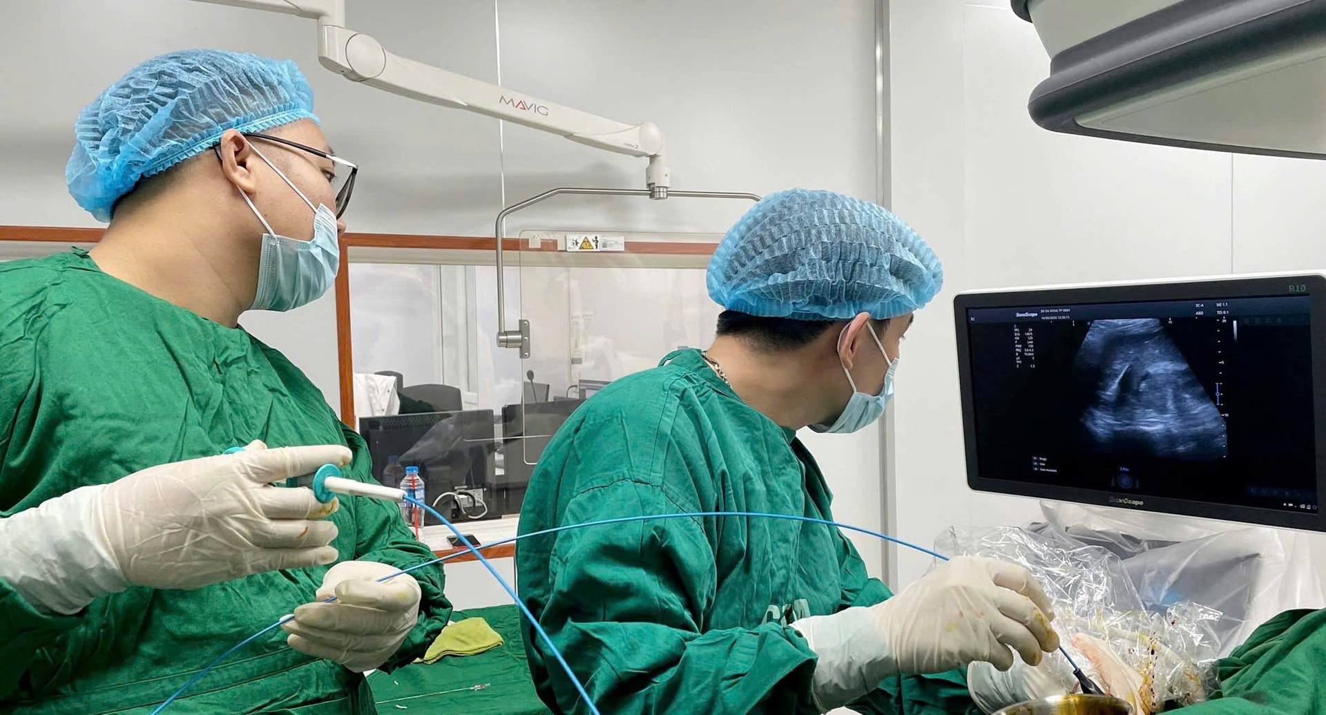 Nuốt nhầm tăm tre, người đàn ông suýt phải phẫu thuật vì áp xe gan- Ảnh 1. Nuốt nhầm tăm tre, người đàn ông suýt phải phẫu thuật vì áp xe gan- Ảnh 1.
