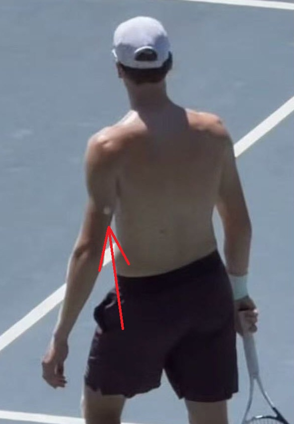 Jannik Sinner đeo thiết bị theo dõi đường huyết trên sân tập chuẩn bị cho Wimbledon 2026