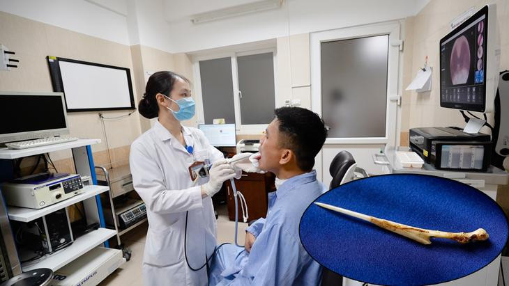 Cố nuốt một miếng cơm để 'chữa mẹo' hóc xương, người đàn ông bị dị vật đâm xuyên qua thực quản - Ảnh 1.
